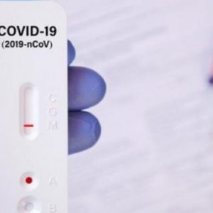 Test rápido Covid 19